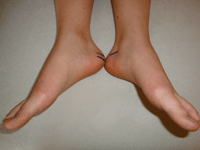 Hypnosetherapie