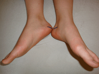 Hypnosetherapie